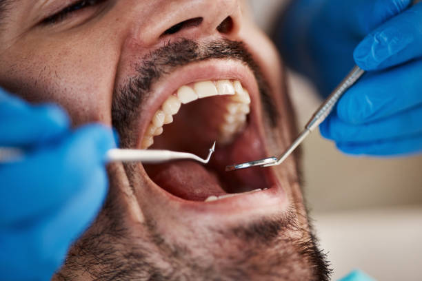 Best Knocked-Out Tooth (Avulsed Tooth) Treatment in Ligh, NE